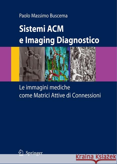 Sistemi ACM E Imaging Diagnostico: Le Immagini Mediche Come Matrici Attive Di Connessioni Buscema, Paolo Massimo 9788847055483 Springer