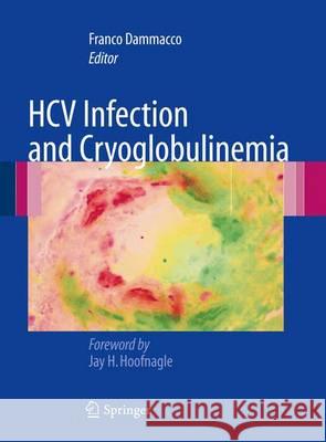 Hcv Infection and Cryoglobulinemia Dammacco, Franco 9788847055810 Springer