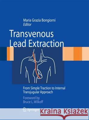 Transvenous Lead Extraction: From Simple Traction to Internal Transjugular Approach Bongiorni, Maria Grazia 9788847056145 Springer