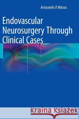 Endovascular Neurosurgery Through Clinical Cases Aristotelis P. Mitsos 9788847056862 Springer Verlag