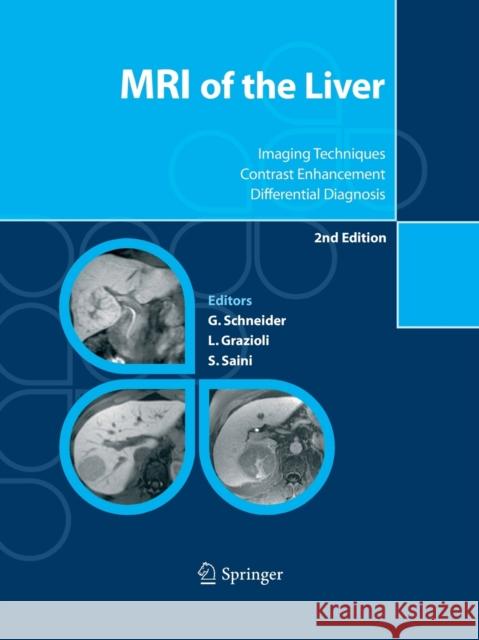MRI of the Liver: Imaging Techniques, Contrast Enhancement, Differential Diagnosis Schneider, Günther 9788847057937 Springer