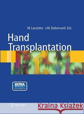 Hand Transplantation Petruzzo, Palmina 9788847057968 Springer