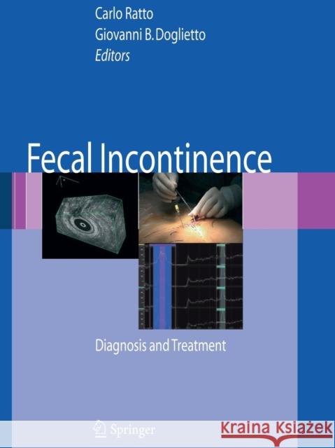 Fecal Incontinence: Diagnosis and Treatment Lowry, A. C. 9788847057999 Springer