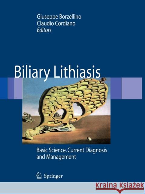 Biliary Lithiasis: Basic Science, Current Diagnosis and Management Borzellino, Giuseppe 9788847058026 Springer