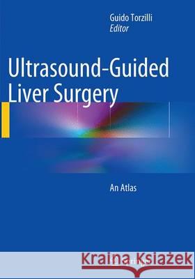 Ultrasound-Guided Liver Surgery: An Atlas Torzilli, Guido 9788847058323 Springer