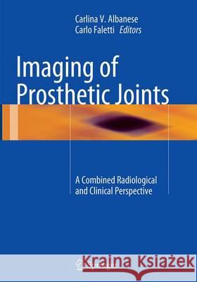 Imaging of Prosthetic Joints: A Combined Radiological and Clinical Perspective Albanese, Carlina V. 9788847058606 Springer