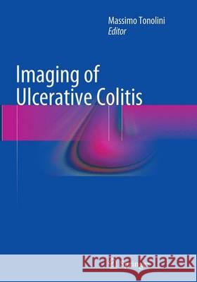 Imaging of Ulcerative Colitis Massimo Tonolini 9788847058620 Springer