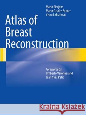 Atlas of Breast Reconstruction Mario Rietjens Mario Casale Visnu Lohsiriwat 9788847058644