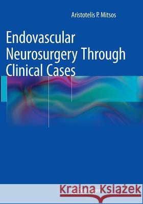 Endovascular Neurosurgery Through Clinical Cases Aristotelis P. Mitsos 9788847058767 Springer