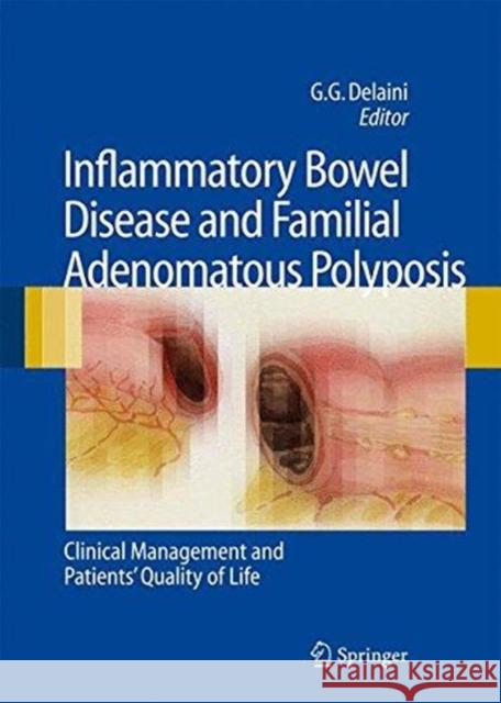Inflammatory Bowel Disease and Familial Adenomatous Polyposis: Clinical Management and Patients' Quality of Life Delaini, Gian Gaetano 9788847058842 Springer