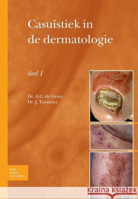 Casuïstiek in de Dermatologie - Deel I Groot, Anton C. 9789031361885 Bohn Stafleu Van Loghum