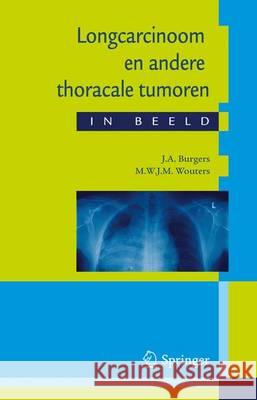 Longcarcinoom En Andere Thoracale Tumoren in Beeld: Casuïstiek in Een Breder Perspectief Burgers, J. A. 9789031362615 Bohn Stafleu Van Loghum
