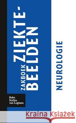 Zakboek Ziektebeelden Neurologie Linden, Karin 9789031364633 Bohn Stafleu Van Loghum