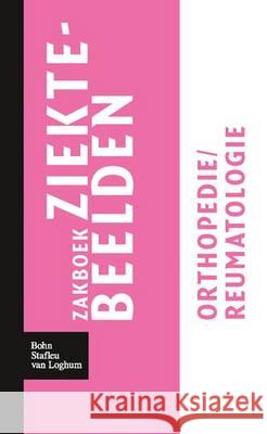 Zakboek Ziektebeelden Orthopedie / Reumatologie Linden, Karin 9789031364640 Bohn Stafleu Van Loghum