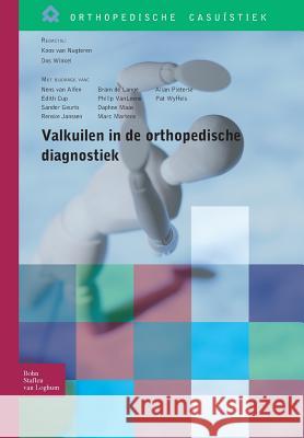 Valkuilen in de Orthopedische Diagnostiek Van Nugteren, Koos 9789031374755 Bohn Stafleu Van Loghum