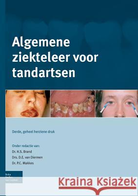 Algemene Ziekteleer Voor Tandartsen Brand, H. S. 9789031387281 Bohn Stafleu Van Loghum