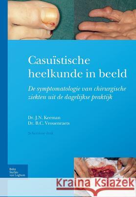 Casuïstische Heelkunde in Beeld: Symptomatologie Van Chirurgische Ziekten in de Dagelijkse Praktijk Keeman, J. N. 9789031392285 Bohn Stafleu Van Loghum
