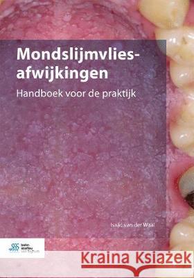 Mondslijmvliesafwijkingen: Handboek Voor de Praktijk Isaac Va 9789036824019 Bohn Stafleu Van Loghum