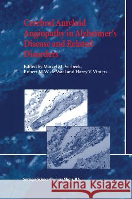 Cerebral Amyloid Angiopathy in Alzheimer's Disease and Related Disorders M. M. Verbeek R. M. De Waal Harry V. Vinters 9789048154807 Not Avail