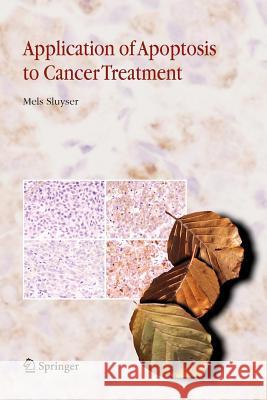 Application of Apoptosis to Cancer Treatment Mels Sluyser 9789048168330
