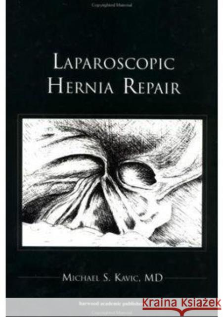 Laparoscopic Hernia Repair Michael S. Kavic 9789057025389 Martin Dunitz