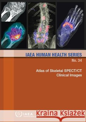 Atlas of Skeletal Spect/CT Clinical Images: IAEA Human Health Series No. 34 International Atomic Energy Agency 9789201034168 International Atomic Energy Agency