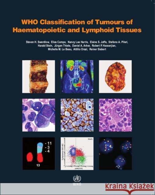 WHO classification of tumours of haematopoietic and lymphoid tissues: Vol. 2 International Agency for Research on Cancer 9789283244943 IARC