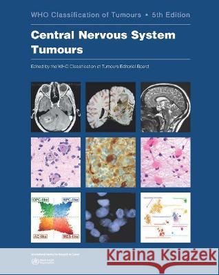 Central Nervous System Tumours: Who Classification of Tumours Who Classification of Tumours Editorial 9789283245087 World Health Organization