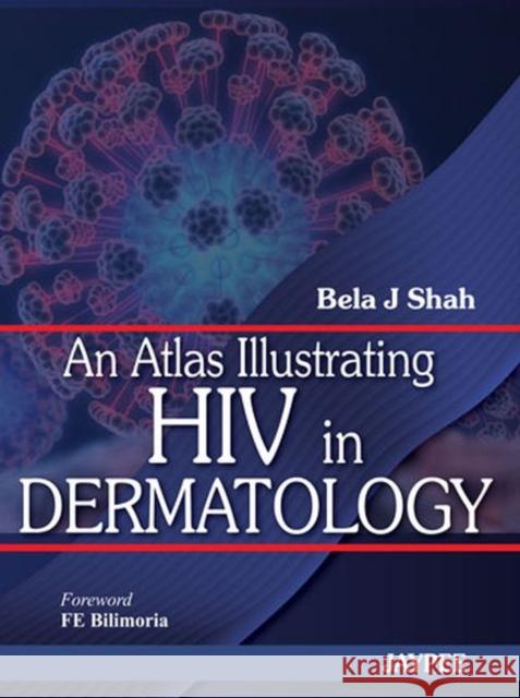 An Atlas Illustrating HIV in Dermatology Bela J. Shah 9789350250501 Jp Medical Ltd