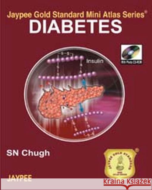 jaypee gold standard mini atlas series: diabetes  Chugh, Sn 9789350250631