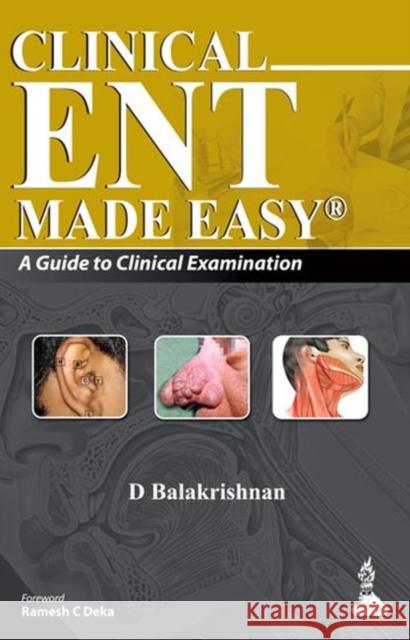 Clinical Ent Made Easy Balakrishnan, D. 9789350250846 0