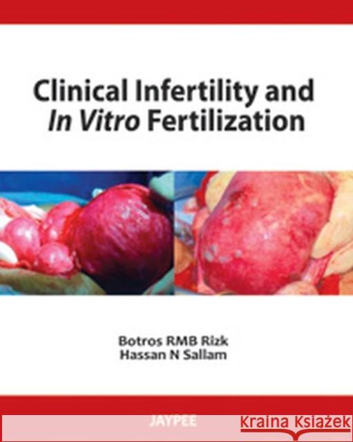 Clinical Infertility and In Vitro Fertilization  9789350250952 