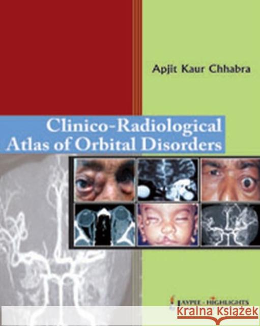 Clinico-Radiological Atlas of Orbital Disorders Apjit Kaur Chhabra 9789350251911 Jaypee Medical Publishers