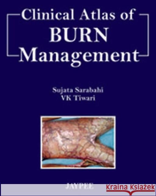 Clinical Atlas of Burn Managment  9789350252765 Jaypee Brothers Medical Publishers