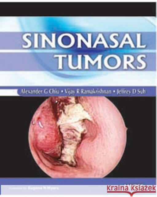 Sinonasal Tumors Chiu, Alexander G. 9789350252826 