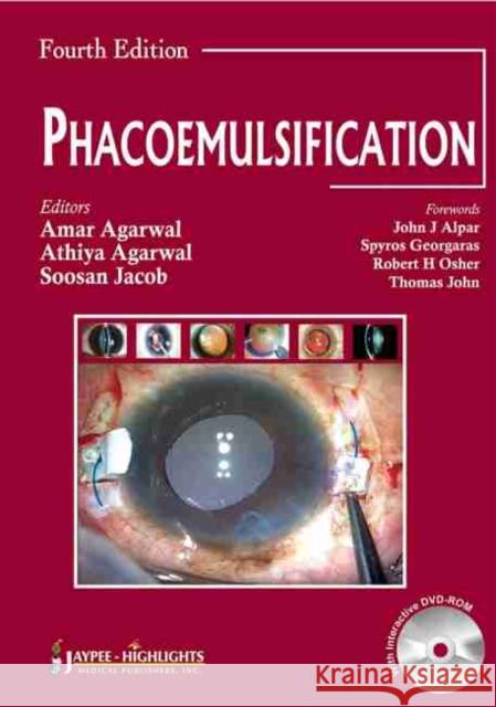 Phacoemulsification, Fourth Edition  9789350254837 