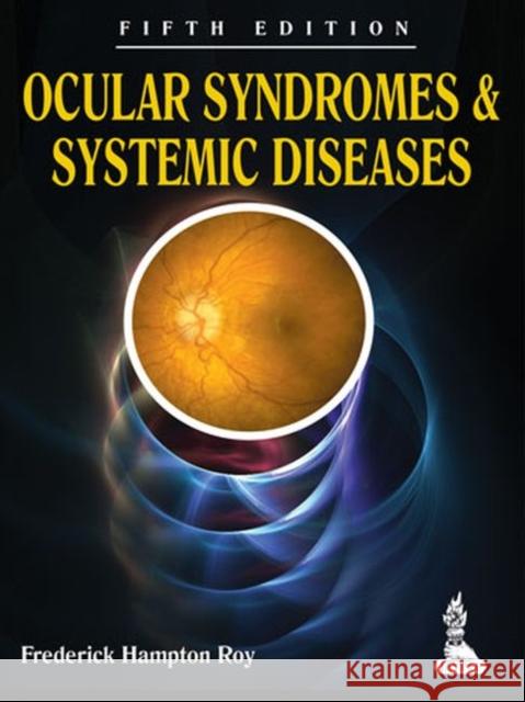 Ocular Syndromes and Systemic Diseases Frederick Hampton Roy 9789350255209 Jp Medical Ltd