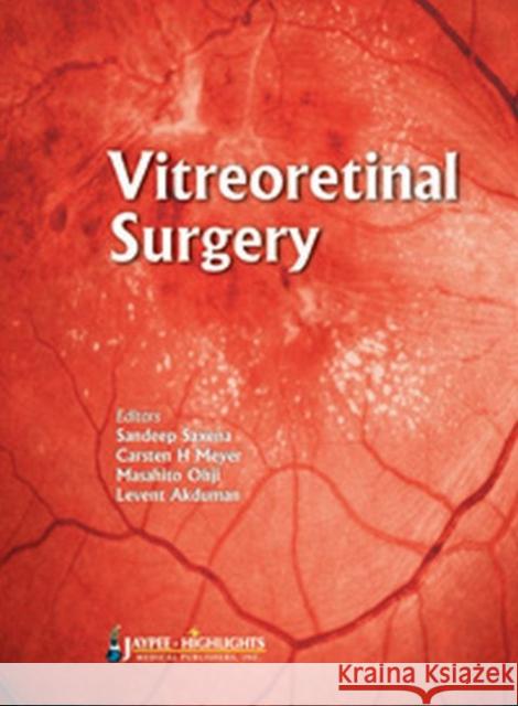 Vitreoretinal  Surgery  9789350255797 Jaypee Brothers Medical Publishers
