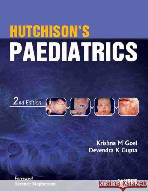 Hutchison's Paediatrics Devendra K Gupta 9789350257715 Jaypee Brothers Medical Publishers