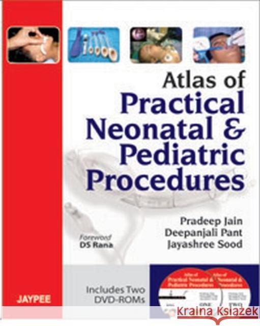 Atlas of Practical Neonatal and Pediatric Procedures Pradeep Jain 9789350257722