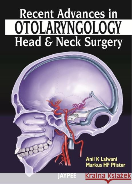 Recent Advances in Otolaryngology - Head and Neck Surgery Anil K Lalwani 9789350257906 0