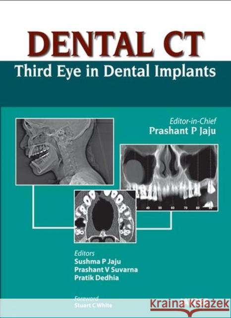 Dental CT Third Eye in Dental Implants Prashant P Jaju 9789350259108