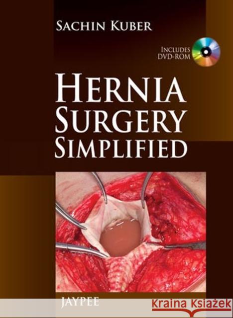 Hernia Surgery Simplified [With DVD ROM] Kuber, Sachin 9789350259498 Jp Medical Ltd
