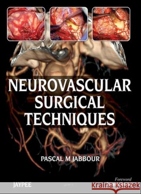 Neurovascular Surgical Techniques Pascal M Jabbour 9789350900888