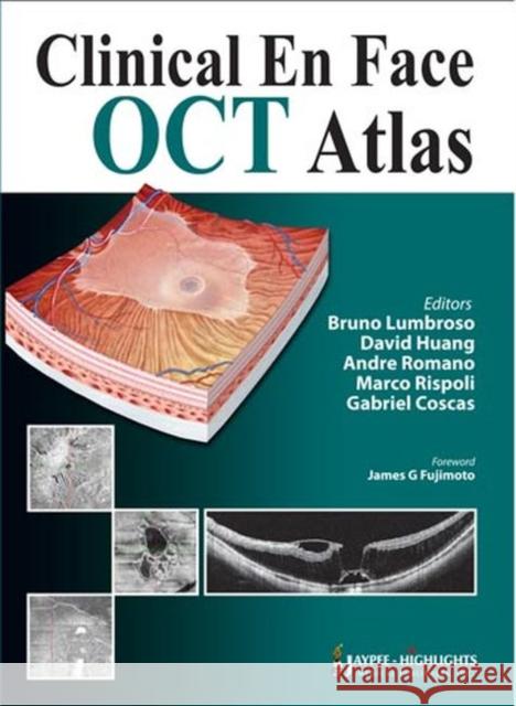 Clinical En Face OCT Atlas Bruno Lumbruse Bruno Lumbroso 9789350902967 Jaypee Brothers Medical Publishers