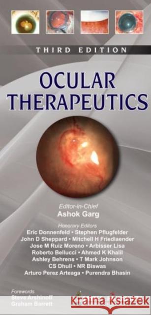 Ocular Therapeutics Ahok Garg 9789350903209 0