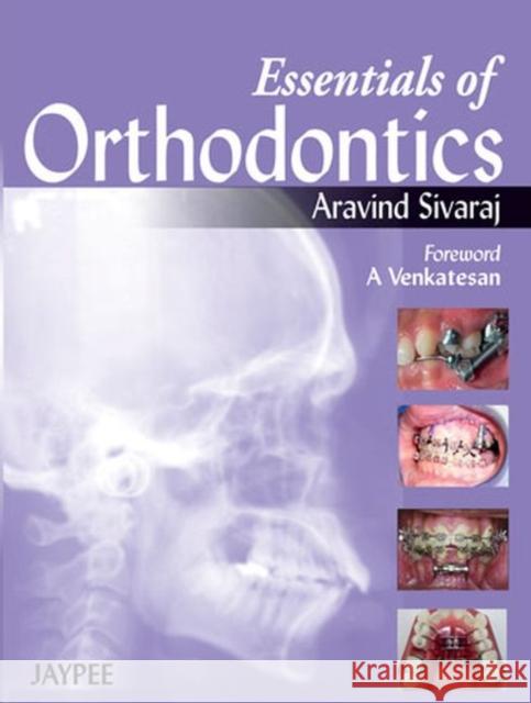 Essentials of Orthodontics Aravind Sivaraj 9789350903292 