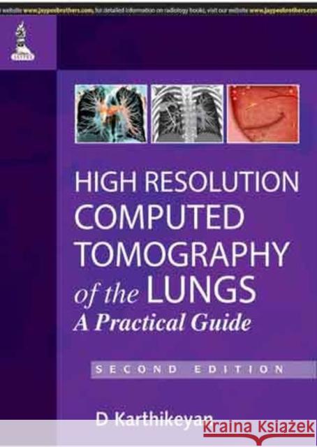 High Resolution Computed Tomography of the Lungs: A Practical Guide D. Karthikeyan 9789350904084 Jp Medical Ltd