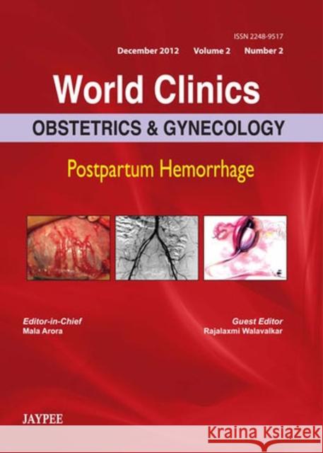 World Clinics: Obstetrics & Gynecology: Postpartum Hemorrhage: Dec 2012, Vol 2, No 2 Arora, Mala 9789350904244 Jp Medical Ltd