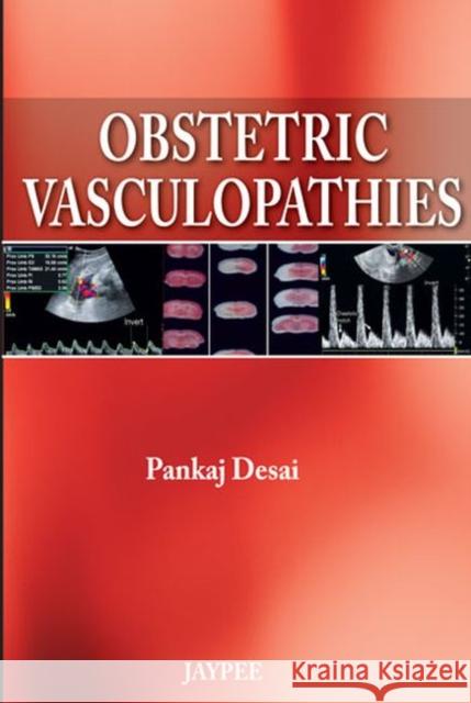 Obstetric Vasculopathies Pankaj Desai 9789350904510 Jp Medical Ltd